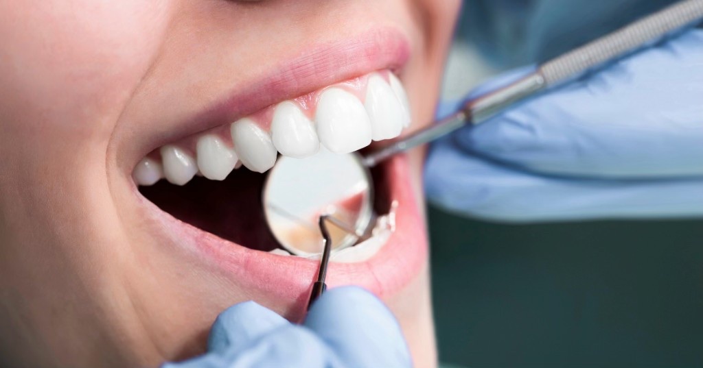 Dental checkup with mirror and explorer during a preventive exam