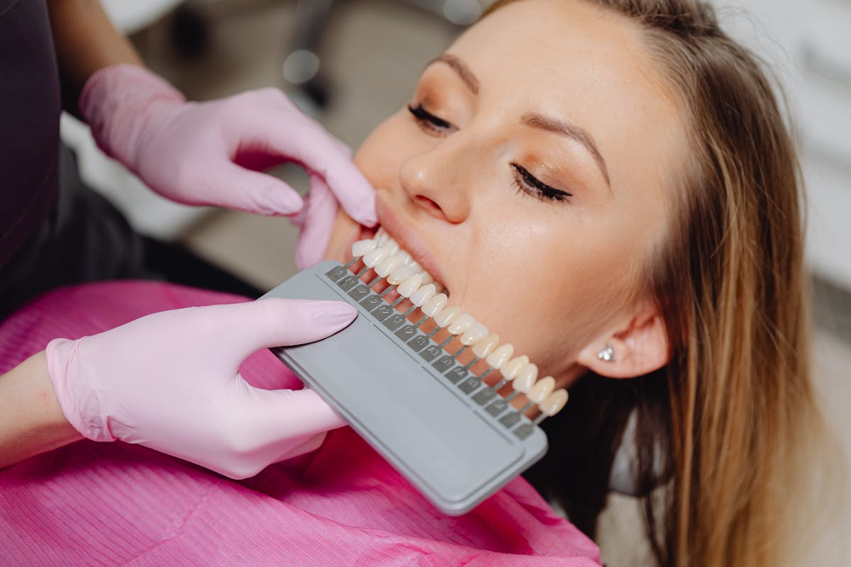 Shade guide used during a cosmetic dental consultation
